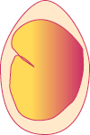 Embryo on Day 18